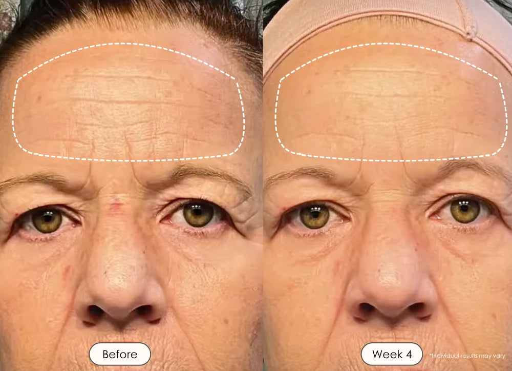 Skin Clarity, Fine Lines