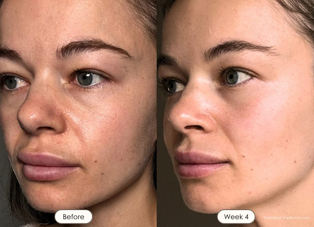Dull Skin