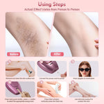 IPL Hair Removal Device Lyla Beauty