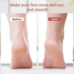 Electric Foot Callus Remover Lyla Beauty
